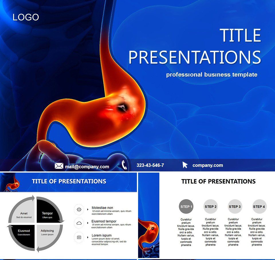 Gastric Ulcer PowerPoint templates | ImagineLayout.com