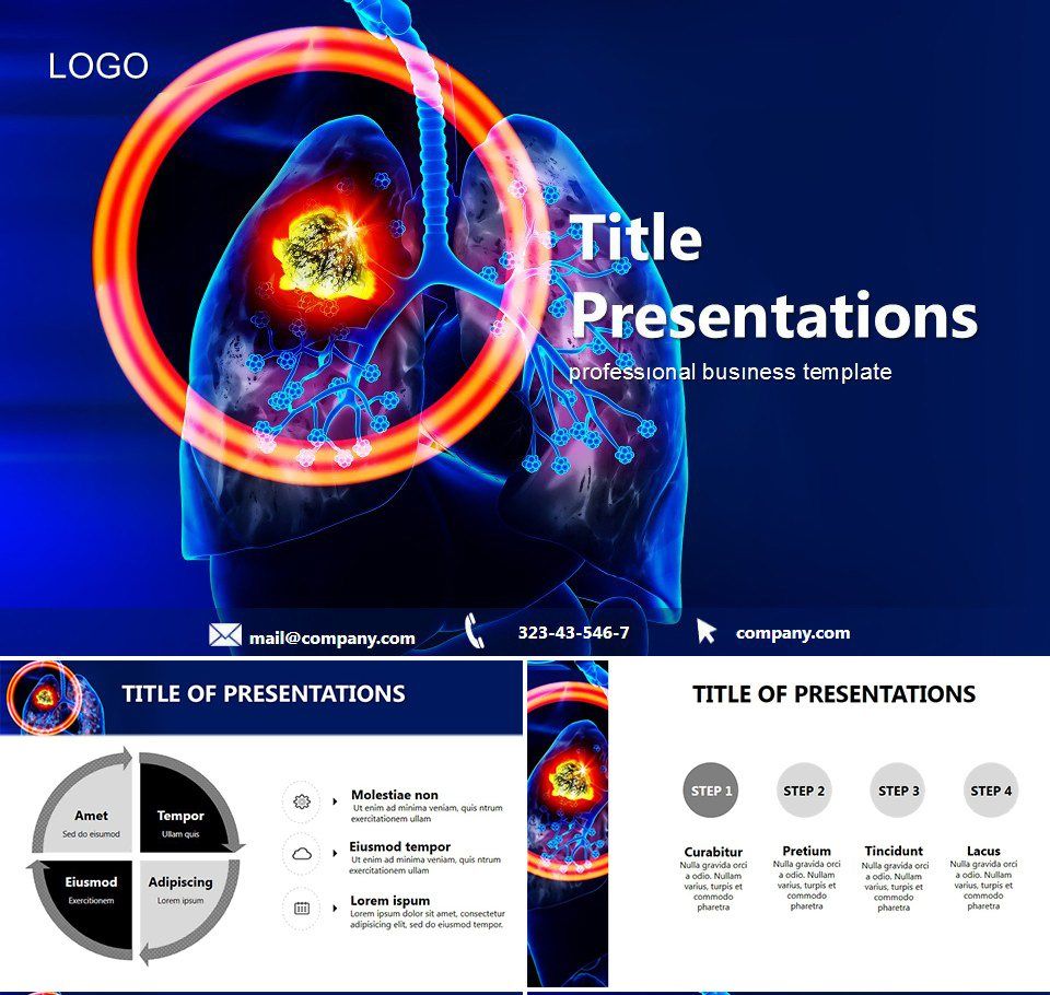 Lung Cancer PowerPoint templates | ImagineLayout.com